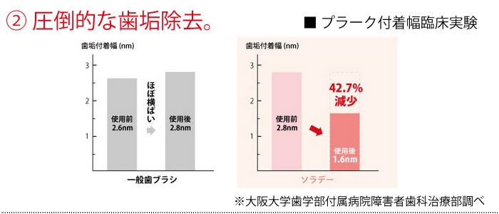 ソラデーN4 圧倒的な歯垢除去